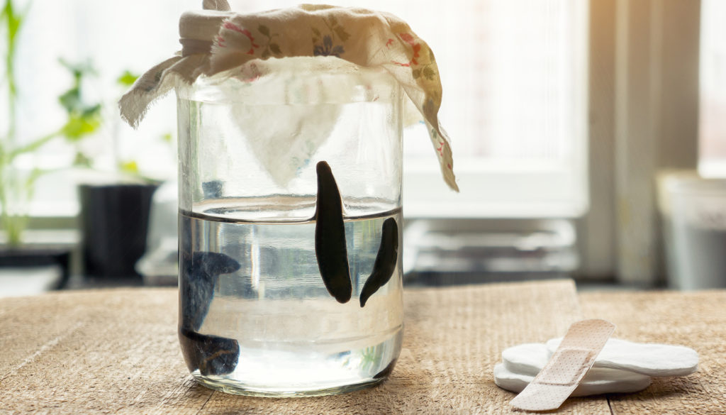 Medical Leeches In A Container With Water. Hirudotherapy. Medical Leeches In A Container With Water. Hirudotherapy.
