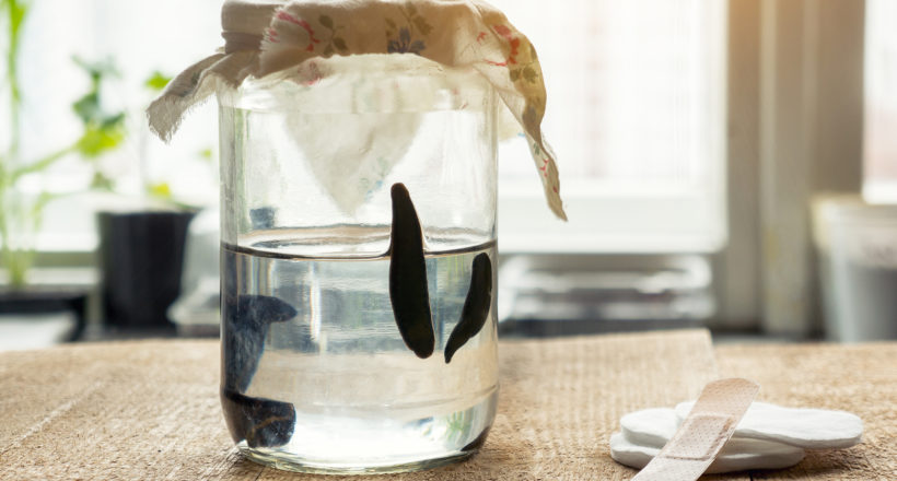 Medical Leeches In A Container With Water. Hirudotherapy. Medical Leeches In A Container With Water. Hirudotherapy.