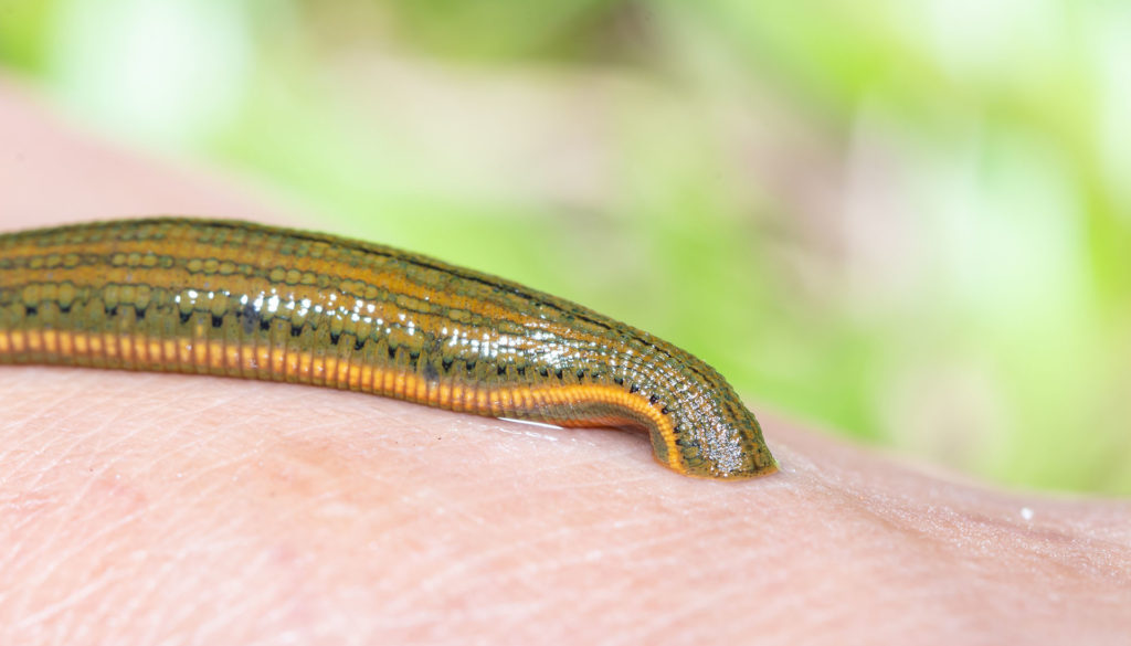 Aquatic Leech Sucking Blood On Skin,Leeches Were Used In Medicin Aquatic Leech Sucking Blood On Skin,Leeches Were Used In Medicin
