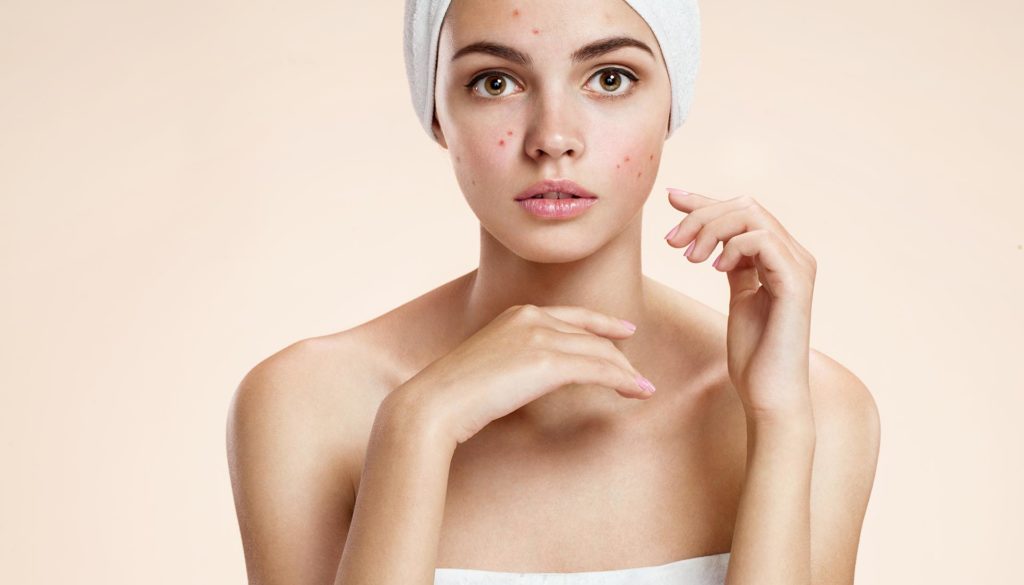 Scowling Girl In Shock Of Her Acne With A Towel On Her Head.