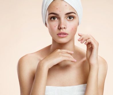 Scowling Girl In Shock Of Her Acne With A Towel On Her Head.